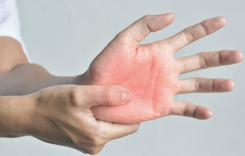 頸腕管綜合症（Carpal Tunnel Syndrome）全攻略：症狀、治療與預防